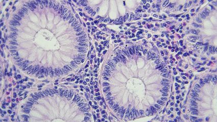 An abstract image of what appears to be purple and white cells under a microscope, they appear as white and purple blobs surrounded by speckles of shades of purple.