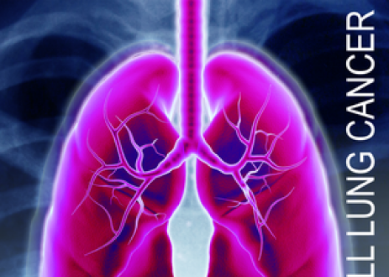 Small Cell Lung Cancer - A Giving Smarter Guide